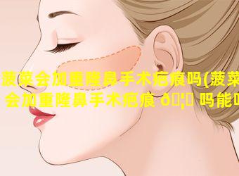 菠菜会加重隆鼻手术疤痕吗(菠菜会加重隆鼻手术疤痕 🦍 吗能吃吗)